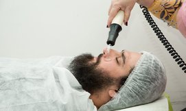 הסרת שיער באפילציה