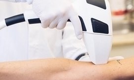 הסרת שיער בלייזר Roses Clinic