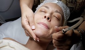 פילינג יהלום The beauty lounge